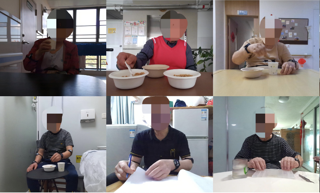 mmBrady: Contactless Upper-Limb Bradykinesia Monitoring for Parkinson's Disease via Semantic-Aware mmWave Sensing in Daily Life